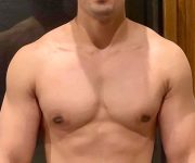 after gynecomastia front view of male patient 688 at Paydar Plastic Surgery