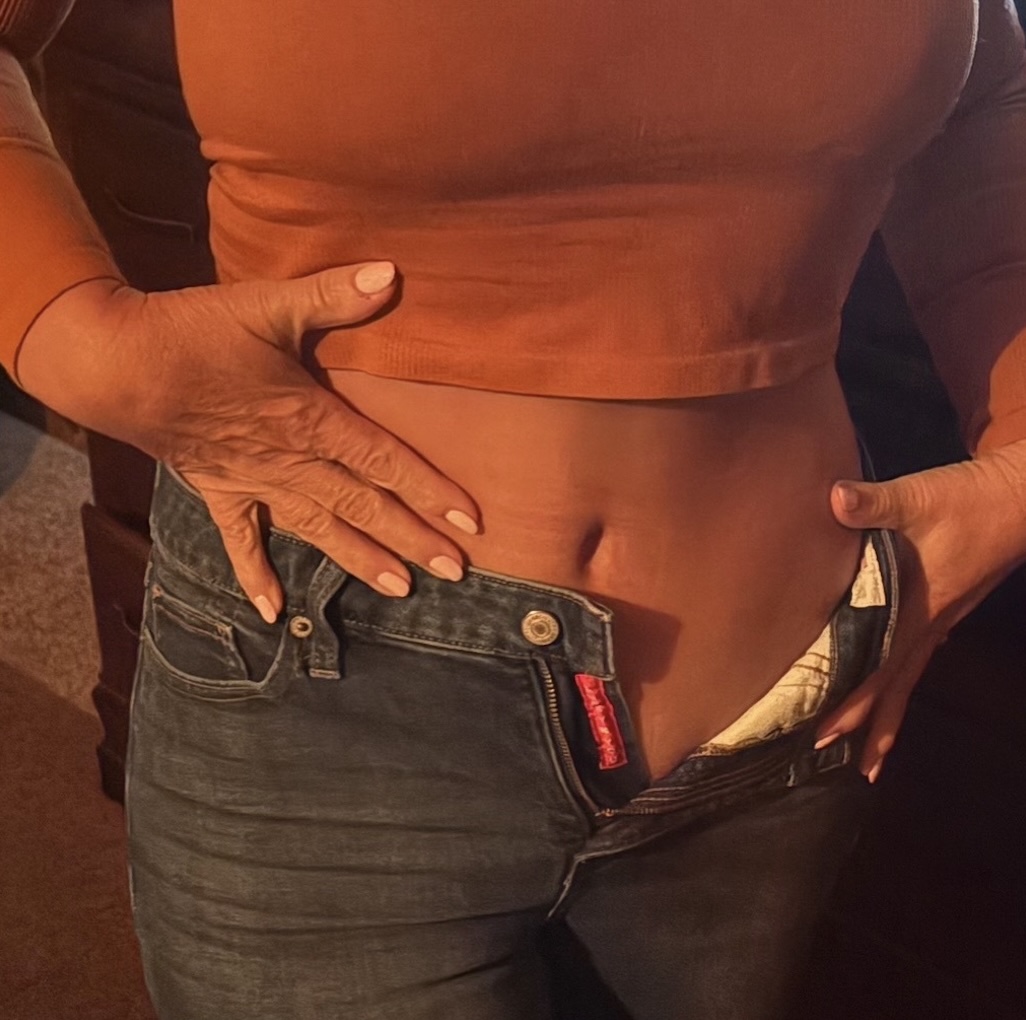 Patient Lower Body Lift Before 5