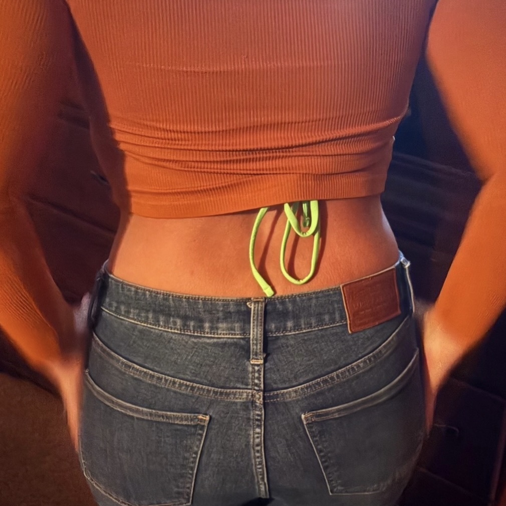 Patient Lower Body Lift Before 6