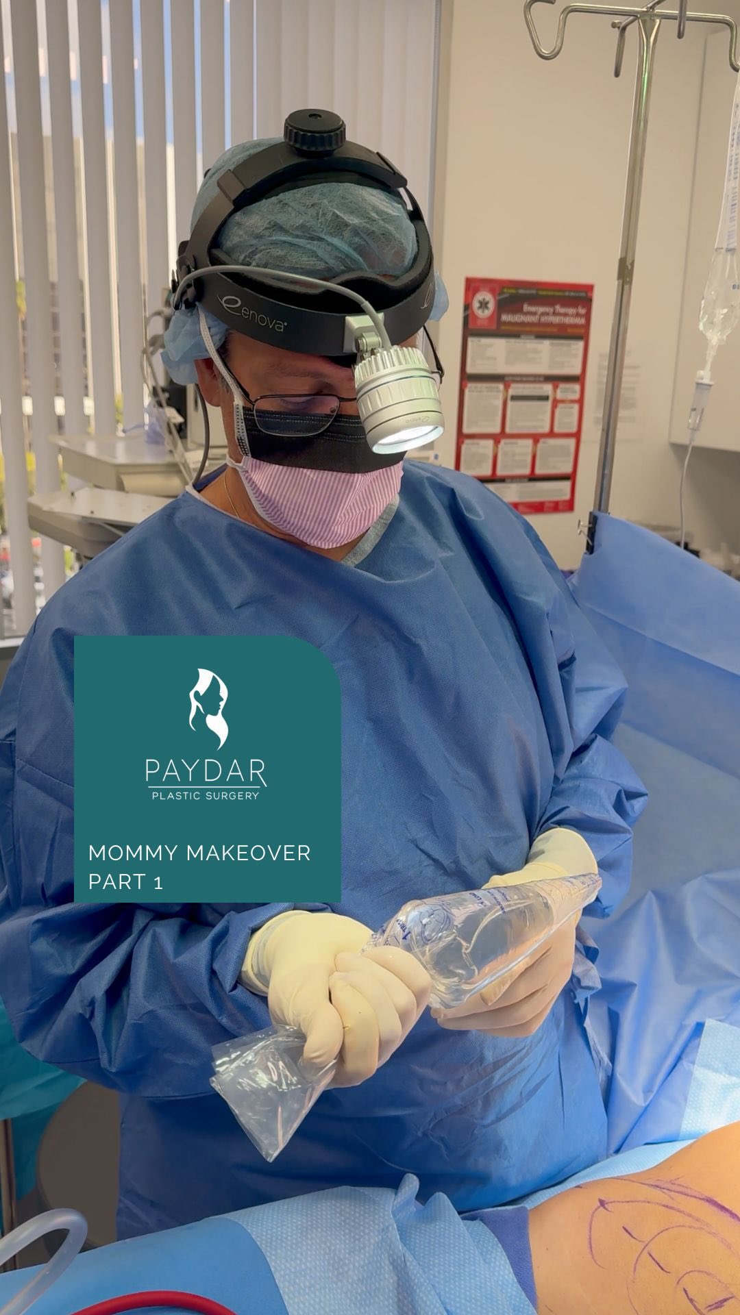 Mommy Makeover, Part 1…. One of the questions we hear all the time is, “How does the implant fit through such a small incision?” Here’s your answer! Watch Dr. Paydar use a Keller Funnel to place the implant during surgery