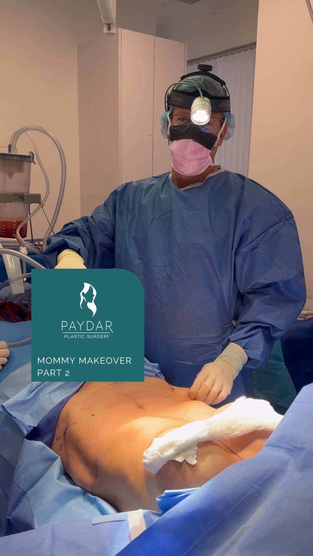 Mommy makeover… Part 2! Dr. Paydar is doing liposuction before he tightens the abdomen 6 week post op photos posted at the end What other surgical procedures are you curious about?